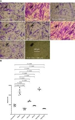 Endothelial-derived microvesicles promote pro-migratory cross-talk with smooth muscle cells by a mechanism requiring tissue factor and PAR2 activation
